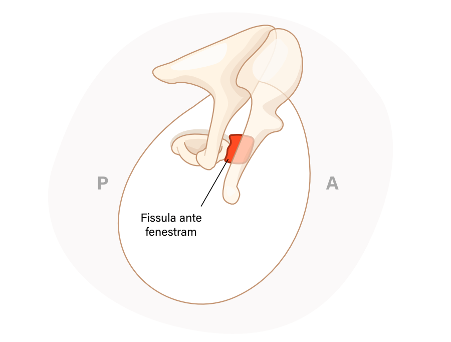 Fissula ante fenestram